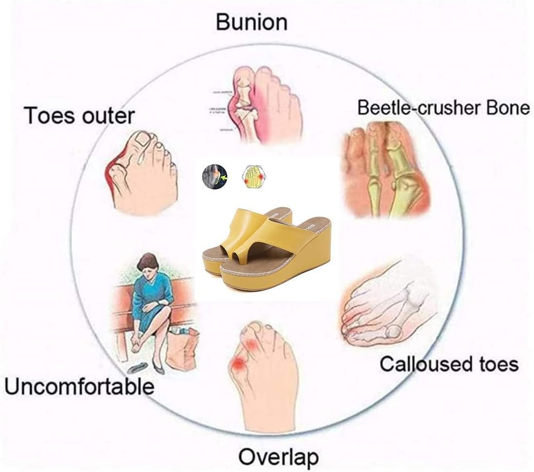 Women's Orthopedic Open Toe Leather Sandal, Orthopedic Bunion Corrector Sandals for Summer Outdoor Hiking Walking Beach (Purple 40 EU) 3 51UHv3isqjL. AC SL1101