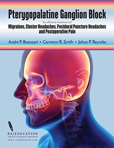 Pterygopalatine Ganglion Block: for effective treatment of Migraine, Cluster Headache, Postdural Puncture Headache & Postoperative Pain (English Edition)