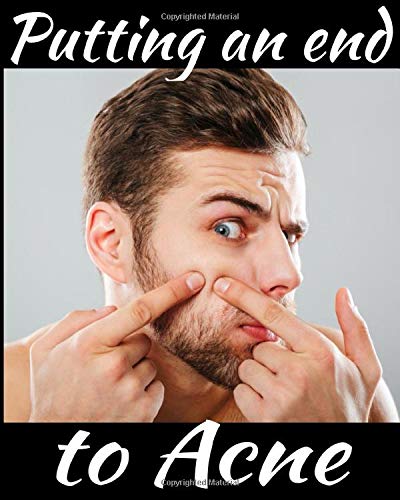 Putting an end to acne: Monitor your acne day after day, with follow-ups on symptoms, diet, treatmen