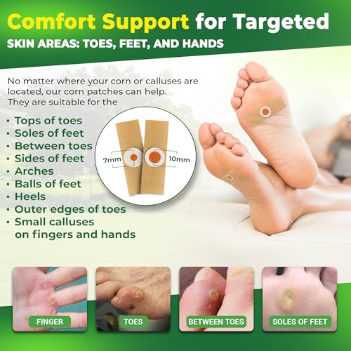 Image of Ulensy Corn Remover Pads for Feet Toes: 30-Pack Salicylic Acid Extra Strength Treatment - Fast Effective Medicated Bandages for Kids Adults Seniors Teens Athletes Runners Hikers Workers Men Women