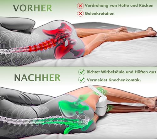 MillyBeas Kniekissen zum Seitenschlafen - Vom Arzt entworfenes orthopädisches Memory-Schaum-Beinkissen mit abnehmbarem Bambusbezug für Rücken-/Hüft-/Gelenk- und Ischiasschmerzlinderung