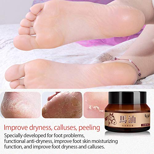 Tumnea Paard olie voetcrème, voetverzorging crème, paardenolie hand-voetcrème anti-schuren van de huid herstelt… - Afbeelding 6