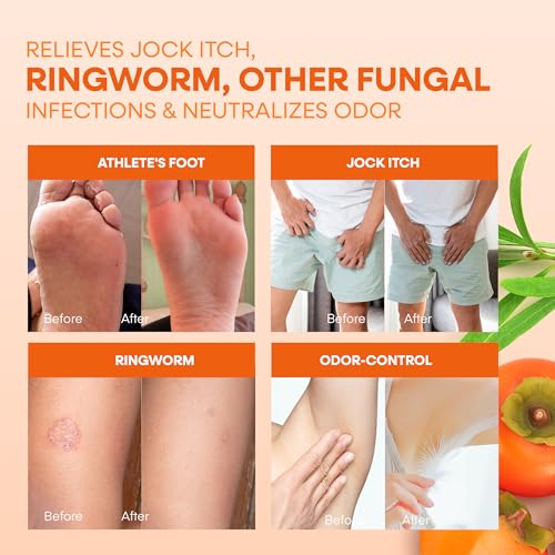 Image of Hermon Antifungal Soap Bar: Antifungal Soap Treatment for Ringworm, Jock Itch & Athlete's Foot with Tea Tree Oil - Medicated Anti Fungal Tea Tree Bar for Skin Fungus - 16oz / 4Bars