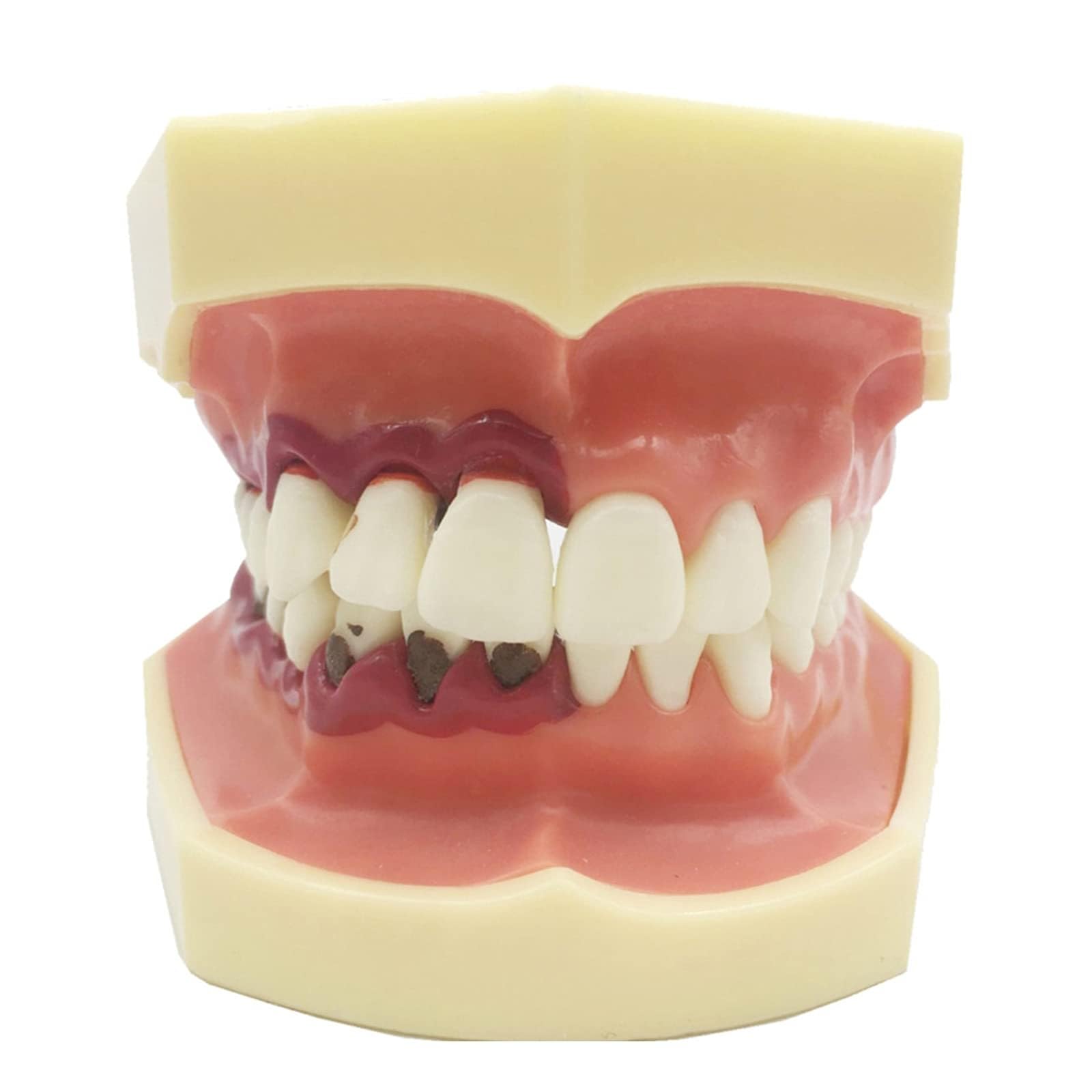 Model przyzębia zębów dentystycznych zęby jamy ustnej dziąsła ząb Typodont Implant Model do nauczania Standard badania