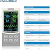 ChoiceMMed Oxímetro de Dedo Portátil para Uso Veterinario - Frecuencia Cardíaca - Monitoreo Médico para Perros, Gatos y Animales Pequeños - Equipo de Monitoreo de Saturación de Oxígeno 5