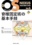 脊椎固定術の基本手技 新OS NEXUS No.6