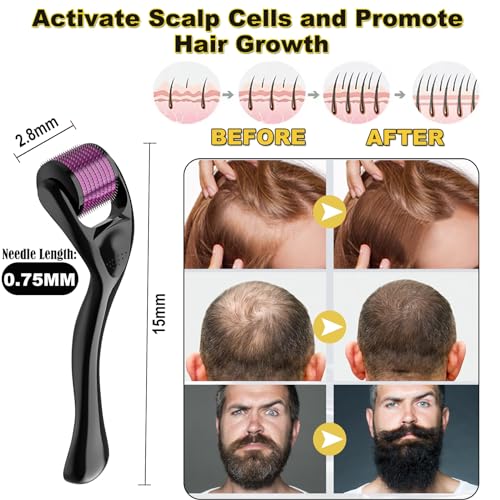 Derma Roller, 0.75mm Beard Growth Roller, 660 Needle Microneedling Roller for Men and Women, Microneedle Roller with Case for Stimulate Hair Growth, Facial Skin Care - Image 3