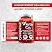 VitaUp Lycopene Supplements for Men - USA Made Prostate Supplements for Men with Natural Tomato Extract - Non-GMO Lycopene Supplement for Prostate, Skin & Antioxidant Support - 120 Count