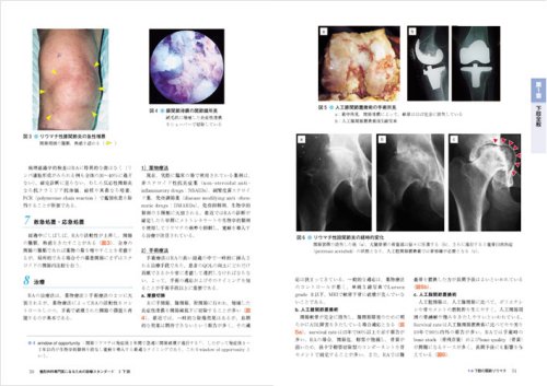 メジカルビュー社｜整形外科｜スタンダード骨折手術治療 下肢 (整形