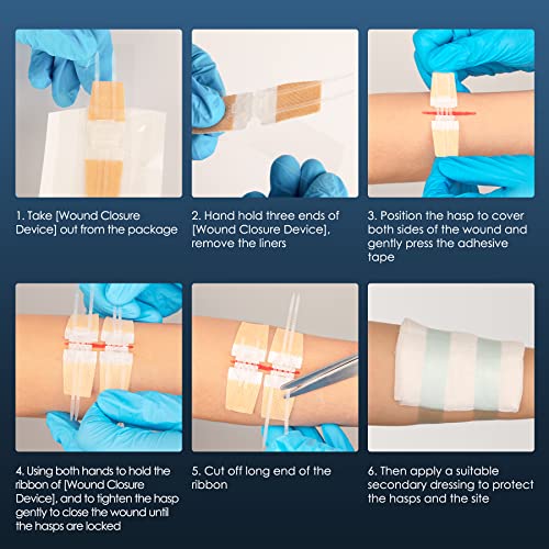 Wound Closure Strip, Sterile First Aid Kit,Zip And Stitch Suture-Free, Adhesive Stitch Emergency Close Wound Device, Flexible Fabric Adhesive Bandages For Wound Care & First Aid Skin Injury (4 Pcs) #TOP3