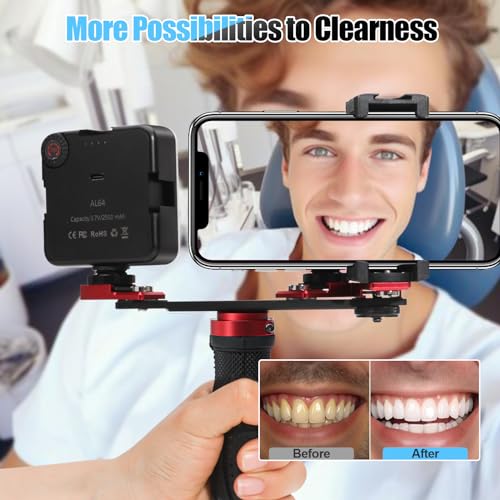 Image of Dental Photography Aid, Oral Cell Phone Camera Fill Light Brightness Led Video Light Studio Lighting Kit for Home, Clinic, Hospital