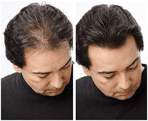 YGH Hair Building Fibers, Conceals Hair Loss in 15 Seconds, 100% Undetectable, 0.98 oz / 28g Bottle - Image 3