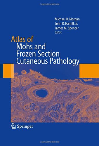 Atlas of Mohs and Frozen Section Cutaneous Pathology