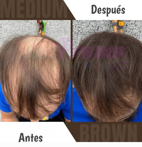 Creatinas, Imagen adicional