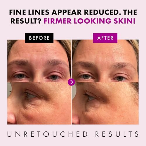 Collagen Anti Aging Face Cream with Patented Matrixyl-3000 & Argireline - 5x More Powerful w/ Pep-Boost Peptide Complex + 10 Antioxidants - Facial Wrinkle Day/Night Cream Face Moisturizer for Women