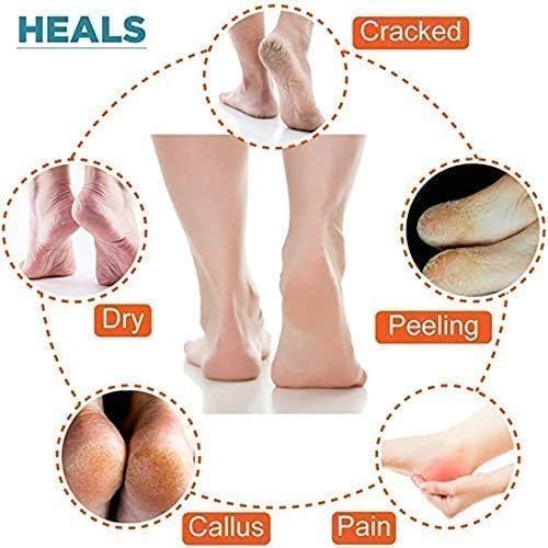 Image of Meliora Silicone Gel Heel Socks for Dry Hard Cracked Heel Repair Pad, Swelling & Pain Relief, Cushion Support, Foot Care, Ankle Protection, Plantar Fasciitis for Men and Women (Blue, 2)