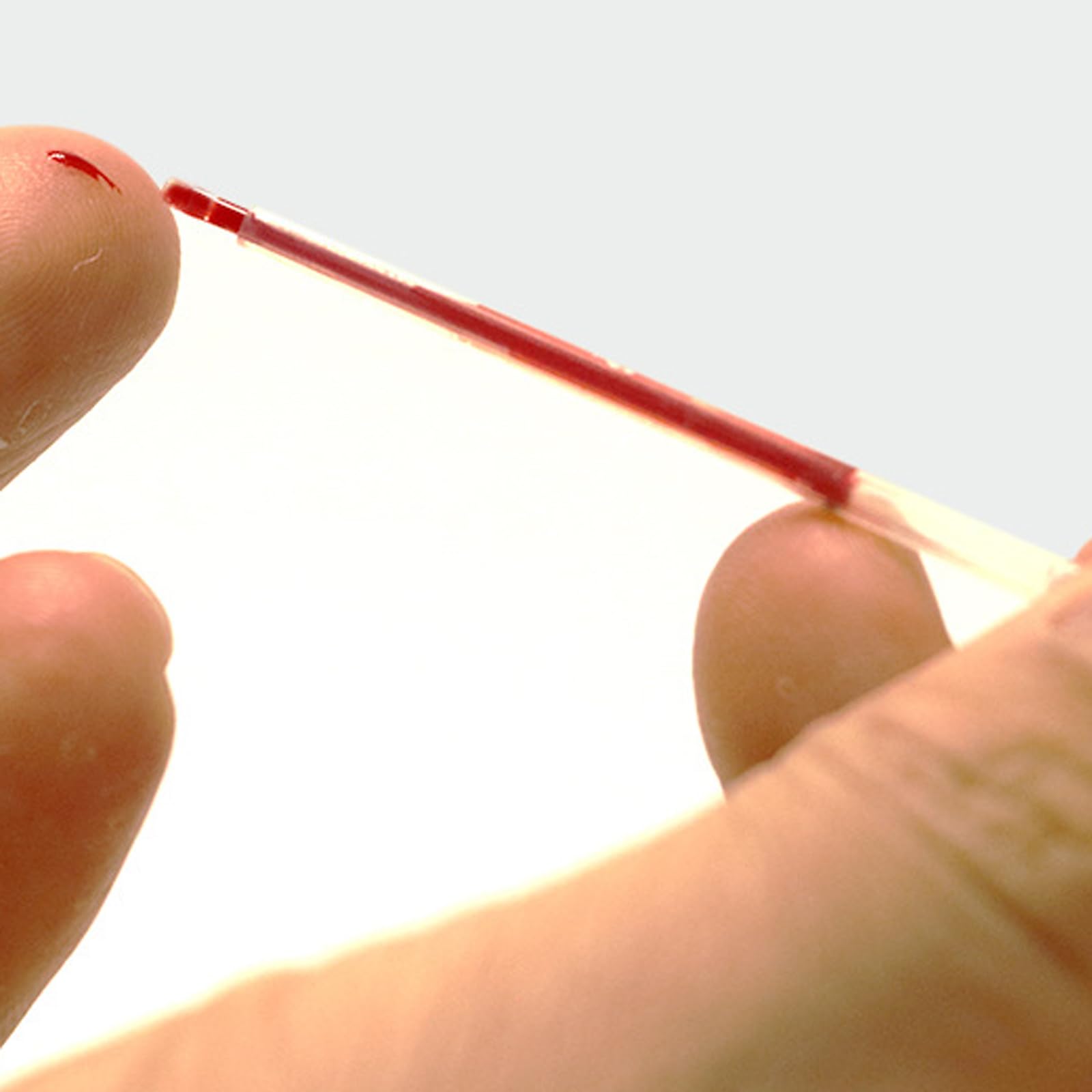 25 strisce reattive per colesterolo totale, misuratore di colesterolo e trigliceridi per la misurazione di colesterolo totale, LDL, HDL (25 pezzi, dispositivo non incluso, solo strisce reattive)
