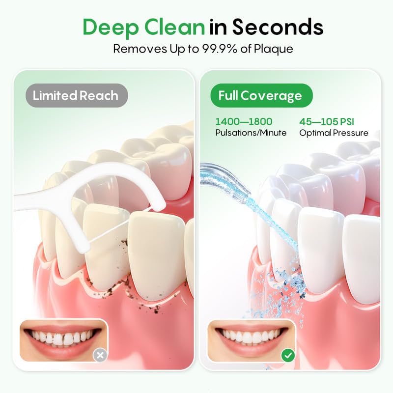 Image of FRESKO Water Dental Flosser, 50-Day Battery Life Oral Irrigator with Constant Pressure, 300ML Water Flosser with 5 Nozzles for Teeth Cleaning, IPX7 Waterproof, Ideal for Braces and Sensitive Gums