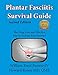 Plantar Fasciitis Survival Guide: The Ultimate Program to Beat Plantar Fasciitis!