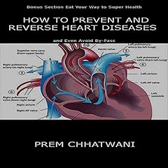 How to Prevent and Reverse Heart Diseases - And Even Avoid By-Pass Audiolibro Por Prem Chhatwani arte de portada