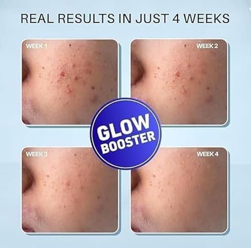 Lazubix DarmaDoc 2% Kojic Acid Glow Fusion Formula Night Cream For Even-Toned and Bright Skin (50 g)