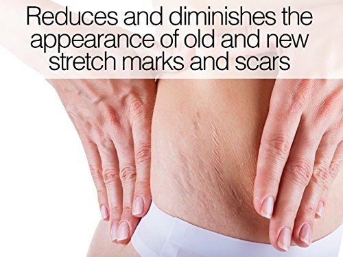 Stretch Mark & Scar Repair Cream-Reduces The Appearance Of Old & New Stretch Marks. Rapidly Fades Away Scars. Body Moisturizing Ingredients To Boost Collagen & Elasticity For Men & Women. #TOP5