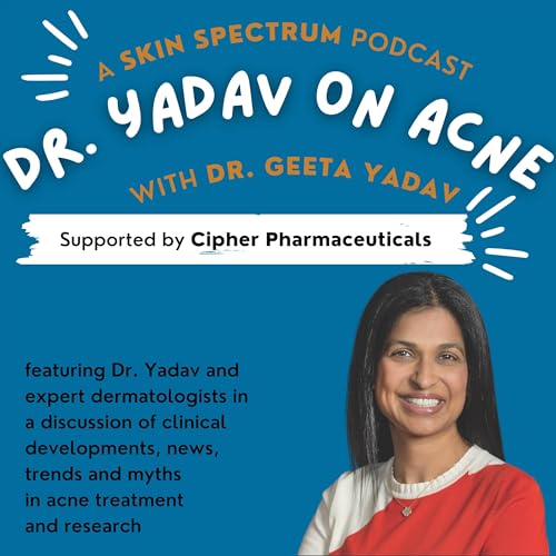 Yadav on Acne cover art