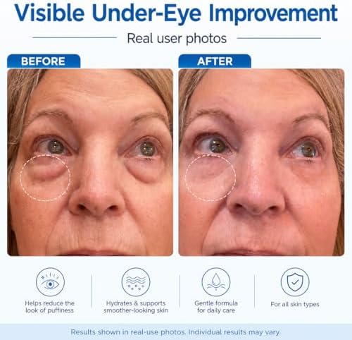Instant Eye Tightener Serum - Visibly Smooths the Look of Eye Bags, Puffiness & Fine Lines in Minutes, with More Noticeable Results in About 10 Minutes - Advanced Polysaccharide Formula for a Smoother, More Natural Finish on Mature Skin, 20 mL, Made in USA