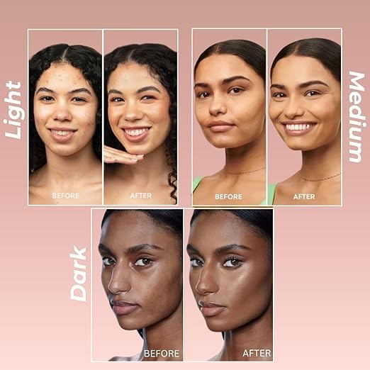 Image of Suroskie My Glow All-In-One Tinted Sunscreen Spf 30 Moisturizer 60 Ml Medium Shade | Natural Glowy Finish | Intense Hydration & Uva /Uvb Protection | Sweat Resistant | Niacinamide Cream For Men & Women