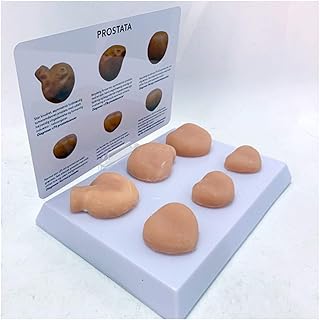 Prostate Model - Prostate Lesion Model - Medical Anatomical Prostate Model - Six Full Size Contrast Normal Prostate and Prostate Cancer Model - for Study Display Teaching
