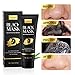 YLNALO Blackhead Remover Mask Kit, Charcoal Peel Off Facial Mask with Brush and Pimple Extractors, Deep Cleansing for Face Nose Blackhead Pores Acne, For All Skin Types (3.5 Fl.oz)