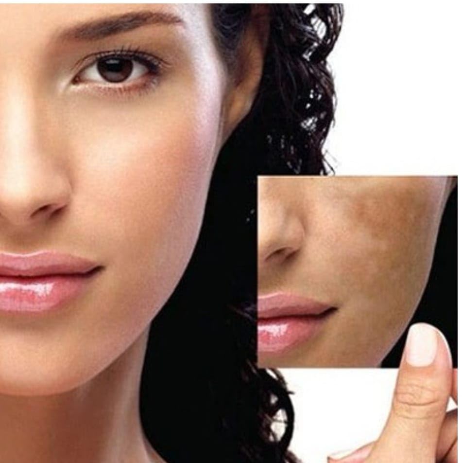 glutathione time to take Discover MEDISCO’s MESO 3 Series: Beauty Innovations main image 0