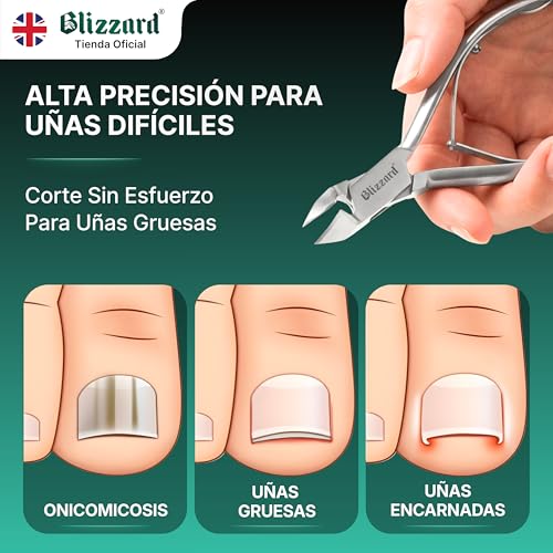 Alicates Blizzard para uñas encarnadas: la solución profesional para pies en casa 2