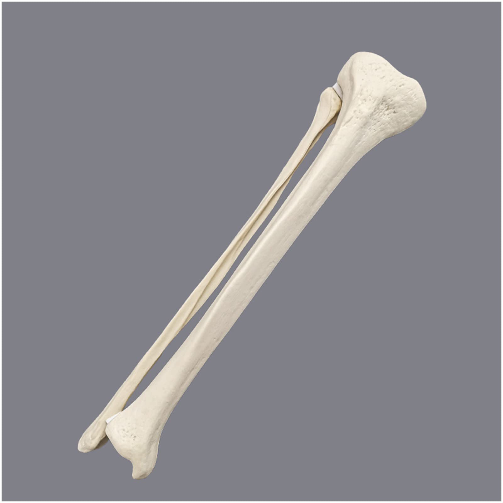 Amazon.co.jp: 医療科学模擬骨大腿骨脛骨モデル - 医療整形外科