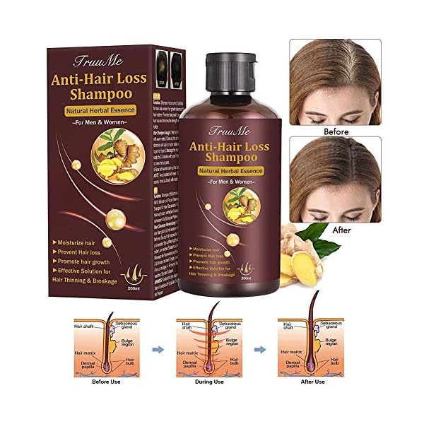 Hair-Growth-Shampoo-Hair-Loss-Shampoo-Hair-Thickening-Shampoo-Helps-Stop-Hair-Loss-Grow-Hair-Fast-Hair-Loss-Treatment-for-Men-Women-220mL Hair Growth Shampoo, Hair Loss Shampoo, Hair Thickening Shampoo, Anti-Thinning Shampoo, Hair Growth-Thickening Shampoo, Hair Loss Treatment, for Stop Hair Loss, Grow Hair Fast, Men & Women, 220ML