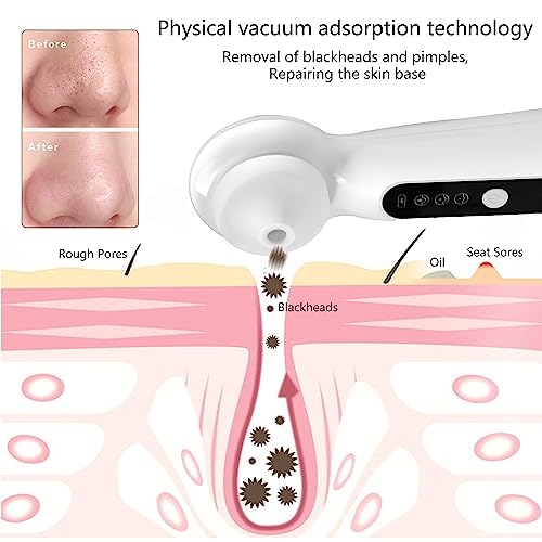 Blackhead Remover with Magnifier, Visible Vacuum Facial Pore Cleanser Sucker Acne Remover 3 Speed & 3 Suction Tips - Image 2