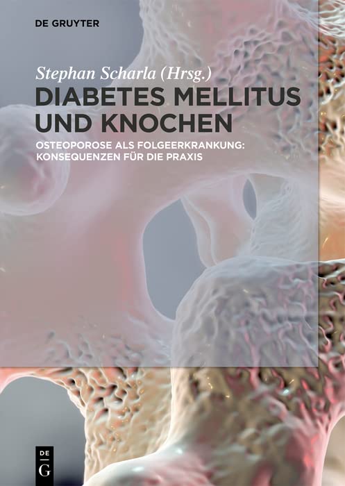 Diabetes Mellitus und Knochen: Osteoporose als Folgeerkrankung: Konsequenzen für die Praxis (German Edition)