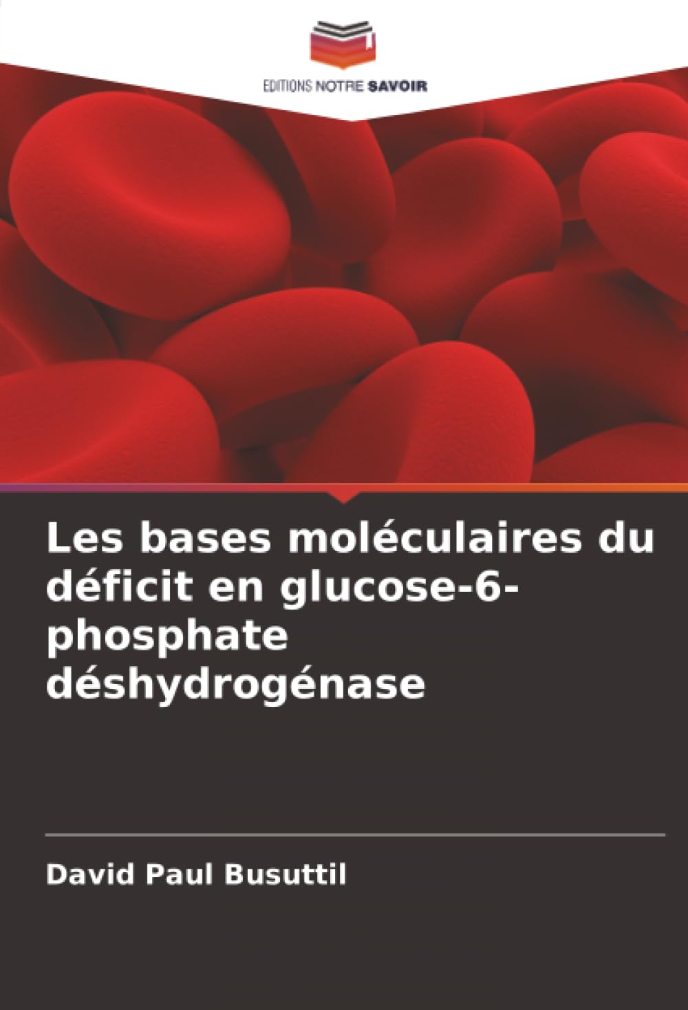 Les bases moléculaires du déficit en glucose-6-phosphate déshydrogénase
