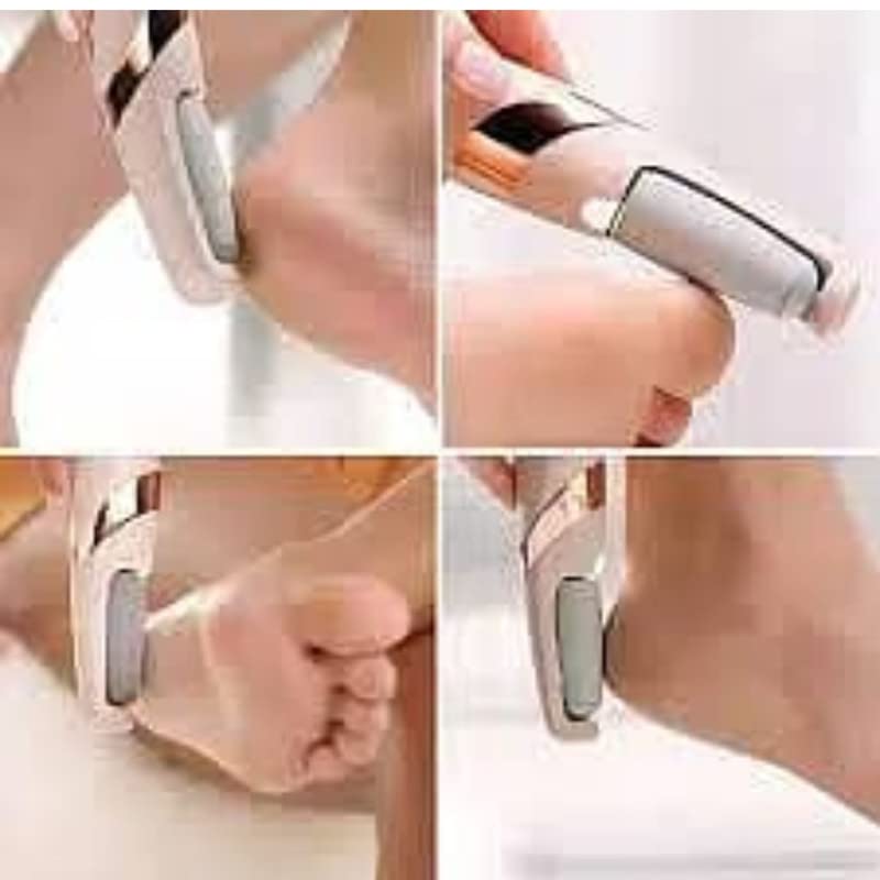 EXXELO Electronic Pedicure Tool Cordless Receable Calls Dead Skin Remover Polishing Wand With 2 Roller Heads EXXELO Electronic Pedicure Tool Cordless Receable Calls Dead Skin Remover Polishing Wand With 2 Roller Heads