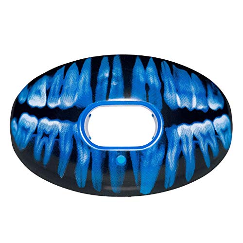 The Best Battle Mouthguard Braces On The Market