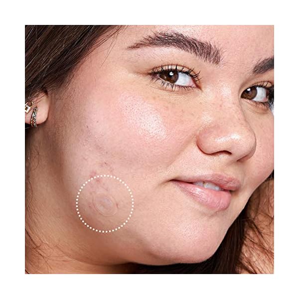 Mighty-Patch-Micropoint-for-Dark-Spots-Hydrocolloid-Post-pimple-Dark-Spot-Brightening-Patch-6-Patches Mighty Patch Micropoint for Dark Spots from Hero Cosmetics - Post-Blemish Dark Spot Patch with 173 Micropoints, Dermatologist Tested and Non-irritating, Not Tested on Animals (6 Count)