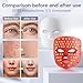 Red Light Therapy for Face,LED Face Mask Light Therapy,USB C Rechargeable,Infrared Light Therapy Mask LED Silicone Mask