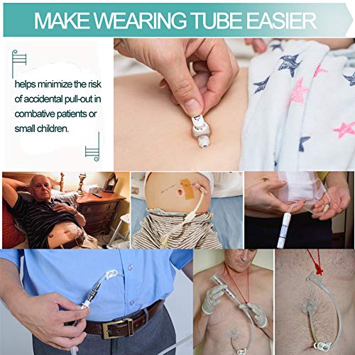 Breathable Peritoneal Dialysis Belt Stretch G/Peg Feeding Tube Holder Pd Catheter Covers Bag Drainage Abdominal Fixation Medical Nursing Supplies, Medium(28-41 Inch) Beige #TOP5