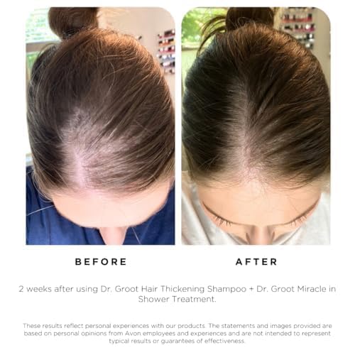 Dr. Groot Scalp Revitalizing Solution Scalp Happiness Set – LIMITED EDITION HOLIDAY SET - Image 4