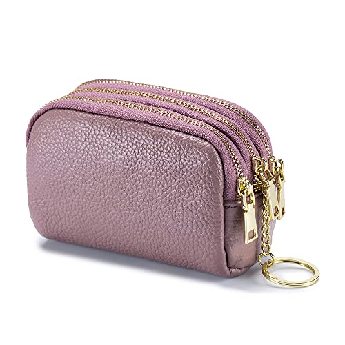 Image of Irsutey Women