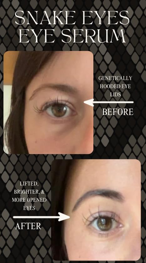 Intoxicated Cosmetics Snake Eyes Eye Serum 15 ml - Bakuchiol Under Eye Solution for Women and Men - Lift | Tighten | Brighten - Image 6