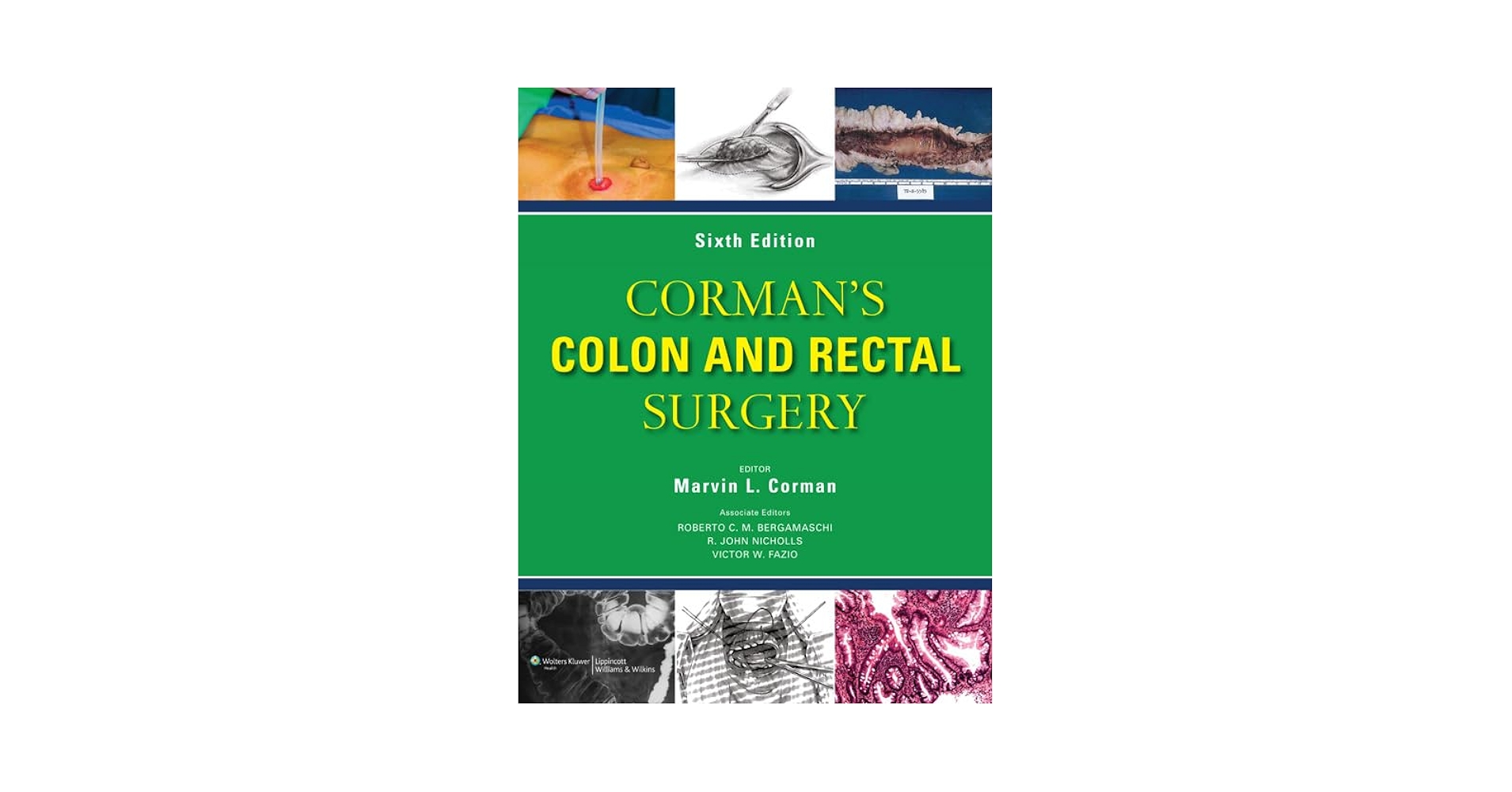 Corman's Colon and Rectal Surgery (COLON AND RECTAL SURGERY