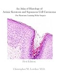 Dermatologic Surgery Skin Cancer and Mohs Surgery- An Atlas of Histology of Actinic Keratosis and Sq