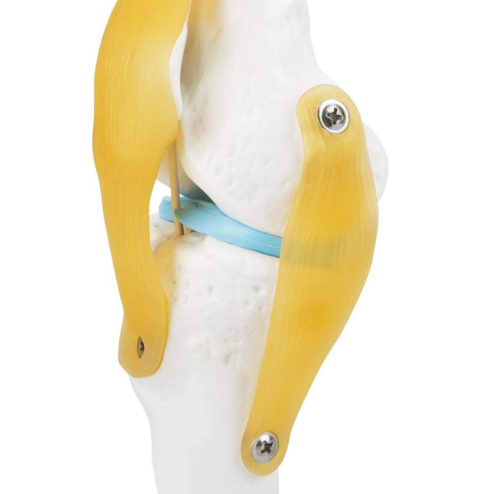 Skelett Anatomie Lebensgroß Anatomisches Kniegelenk Mit Bändern Modell,32CM Skelett Anatomie Wirbelsäule Knochenmodell Medizinisches Kniegelenk Osteoporose Anatomisches Modell Für Hobbyisten