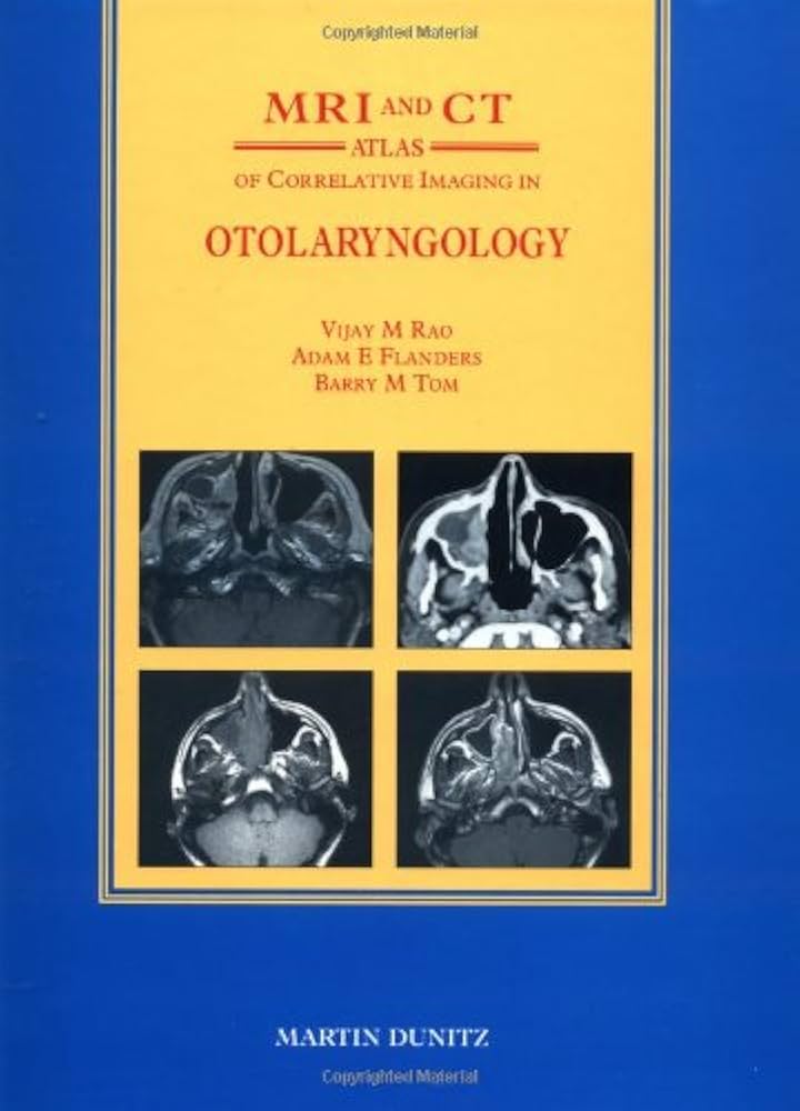 MRI and CT Atlas of Correlative Imaging in Otolaryngology Flanders， Adam E、 Rao， Vijay M; Tom， Barry M MRI and CT Atlas of Correlative Imaging in Otolaryngology